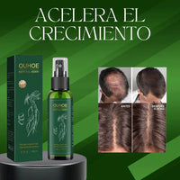 SPRAY CRECIMIENTO PELO Y BARBA OUHOE®