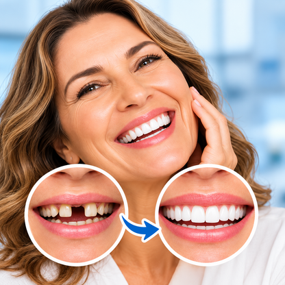 IMPLANTES CARILLAS DENTALES